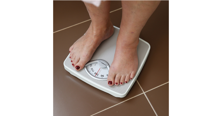 Rapid weight gain image